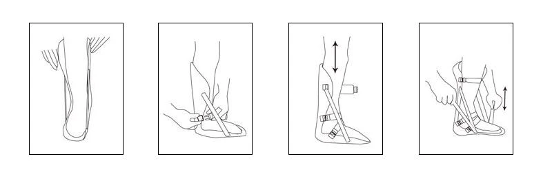 Foot Drop Night Splint Instructions